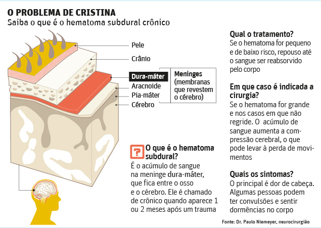 Saiba o que é o hematoma subdural crônico