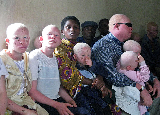 Burundineses assistem a julgamento de acusados de matar albinos e vender membros para rituais de magia na Tanzânia
