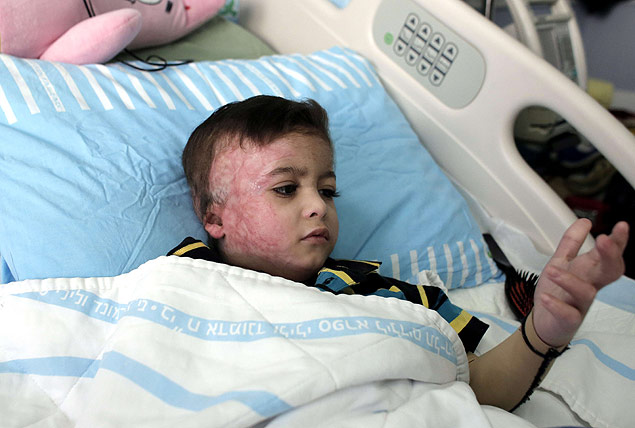 Ahmad Dawabsheh, 4, est internado no hospital Tel Hashomer, em Israel, aps sua famlia ser atacada