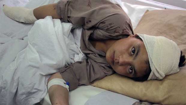 BBC. 338 crianas mortas em 6 meses: os dramticos nmeros da violncia no Afeganisto. Criana afeg  hospitalizada aps um ataque do Taleban em Cabul, em abril deste ano 