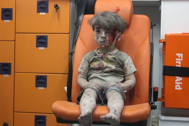 Omran, a four-year-old Syrian boy covered in dust and blood, sits in an ambulance after being rescued from the rubble of a building hit by an air strike in the rebel-held Qaterji neighbourhood of the northern Syrian city of Aleppo late on August 17, 2016. / AFP PHOTO / MAHMOUD RSLAN