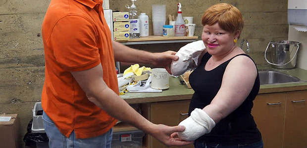 'Meu vizinho cortou minhas mos': a trgica perseguio aos albinos na Tanznia