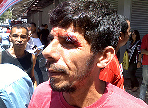 Autônomo Carlos Calixto, 44, militante do PT ferido durante o confronto com cabos eleitorais do PSDB