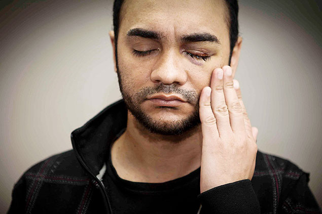 O fotgrafo Srgio Silva, atingido por uma bala de borracha no protesto de 13 de junho em SP 