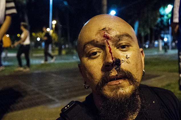 Fotógrafo Adriano Lima, ferido durante confronto em SP