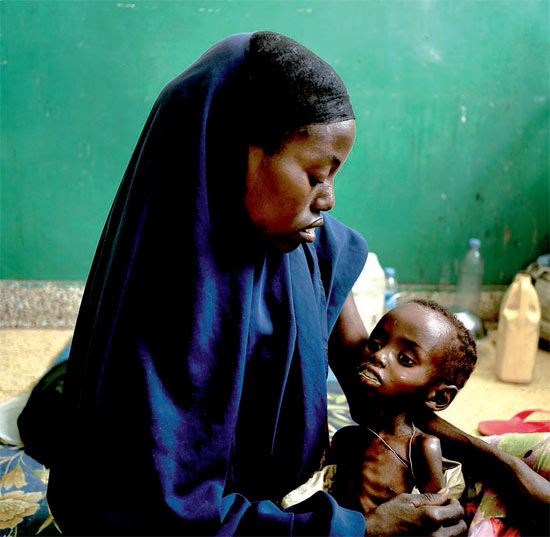 Mulher segura criança com desnutrição no Hospital Benadir, em Mogadício, na Somália