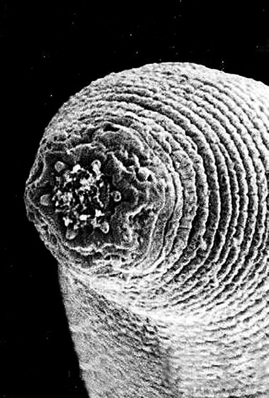 Imagem ilustrativa de um verme parasita