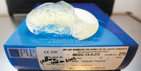 Prótese de silicone adulterado retirado de paciente no consultório do cirurgião Denis Boucq, em Nice, na França