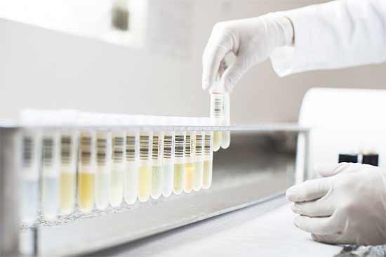 Manipulação de exames com urina para detecção de drogas no laboratório Maxilabor, zona oeste de São Paulo
