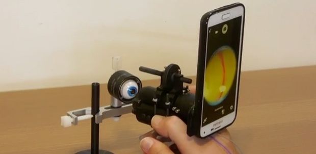 Prottipo do equipamento desenvolvido por brasileiros que permite transformar um smartphone em um aparelho capaz de examinar a retina e o olho humano