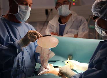 Cirurgio remove implante de silicone defeituoso de paciente em Nice, sudeste da Frana
