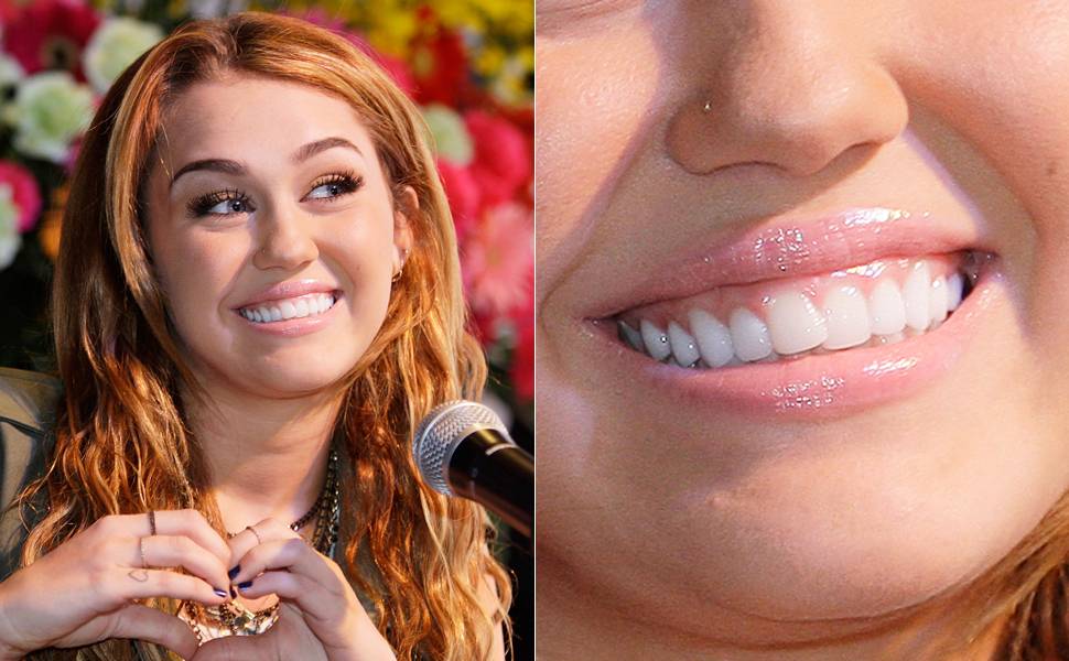 Aos 19 anos, Miley Cyrus está se transformando. Os dentes já passaram por aparelhos, mas o sorriso ainda mantém um charmoso tortinho