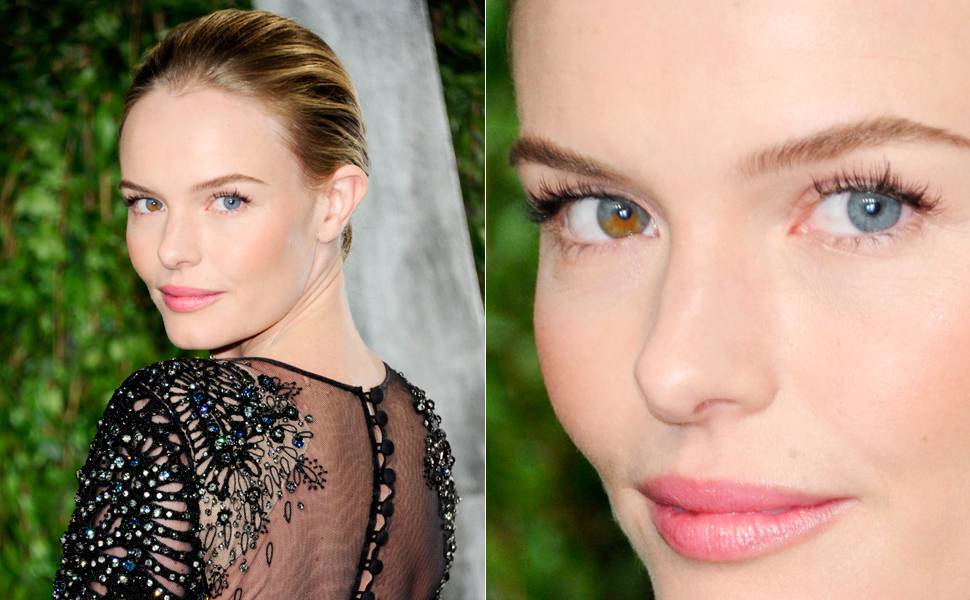 Os olhos de cores diferentes (heterocromia) da atriz Kate Bosworth são uma das imperfeições mais lindas da natureza