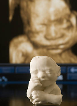 Rosto de feto de 22 semanas impresso em 3D, com imagem de ultrassom ao fundo, em laboratrio em SP
