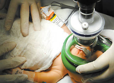 Apelidado de Brigadeirinho, boneco passa por simulao de transplante de fgado