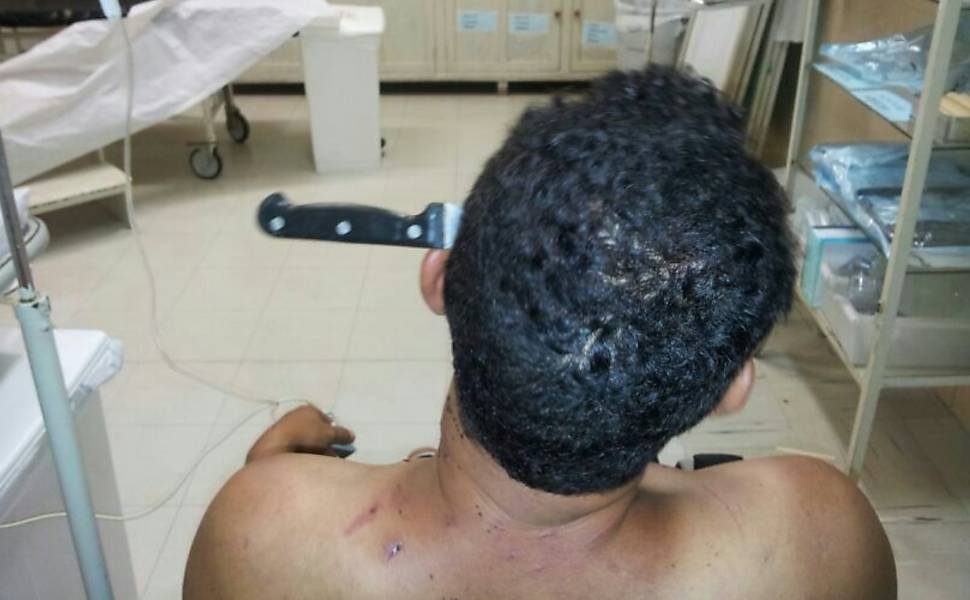 Homem de 40 anos foi atendido no Hospital de Base de Bauru (SP), com uma faca cravada na cabeça no bairro Pampulha; de acordo com a Polícia Militar, o lavrador rural alegou aos policiais que havia golpeado a própria cabeça após brigar com o companheiro