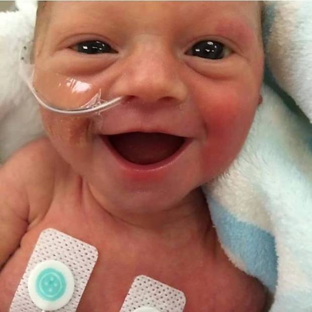 Bebês prematuros sorrindo