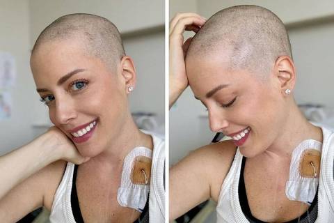 Fabiana Justus Raspa Cabelo Em Tratamento Contra Leucemia