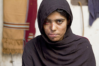 Cena de "Salvando a Face", que apresenta tragédias com mulheres paquistanesas que tiveram os rostos desfigurados por ácido