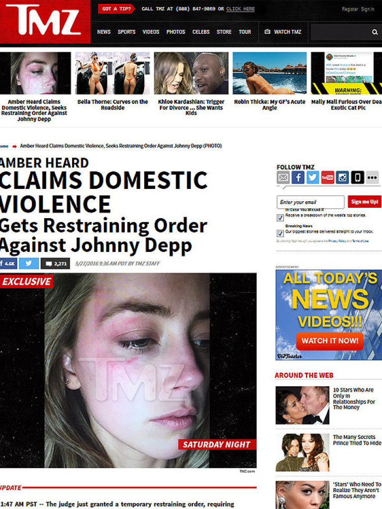 A atriz Amber Heard com hematomas no rosto em foto divulgada pelo site 'TMZ'