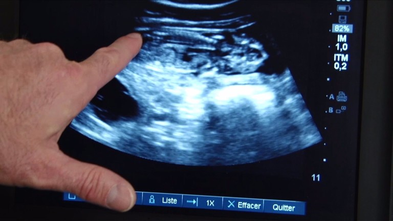 Ultrassonografia de Huan Huan antes do parto, que deve acontecer nos próximos dias