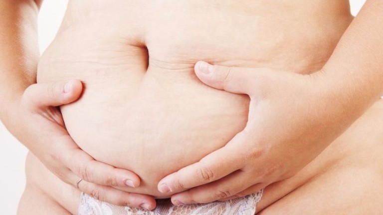 Após a gravidez, os músculos abdominais podem ficar estirados, enfraquecidos e separados