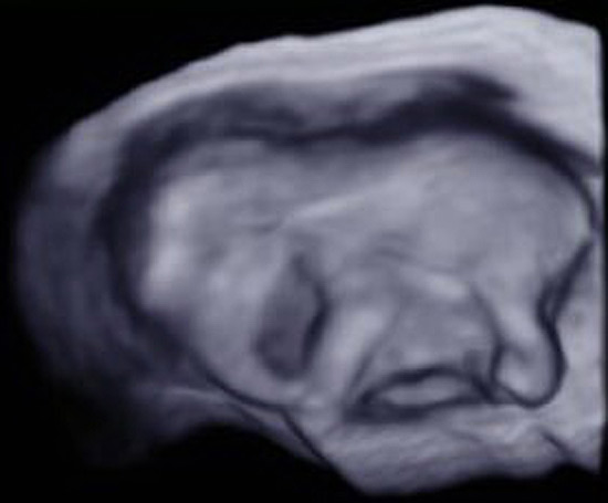 Detalhe do ultrassom do feto de elefante aos 5 meses de gestação, já com tromba, pernas e orelhas reconhecíveis