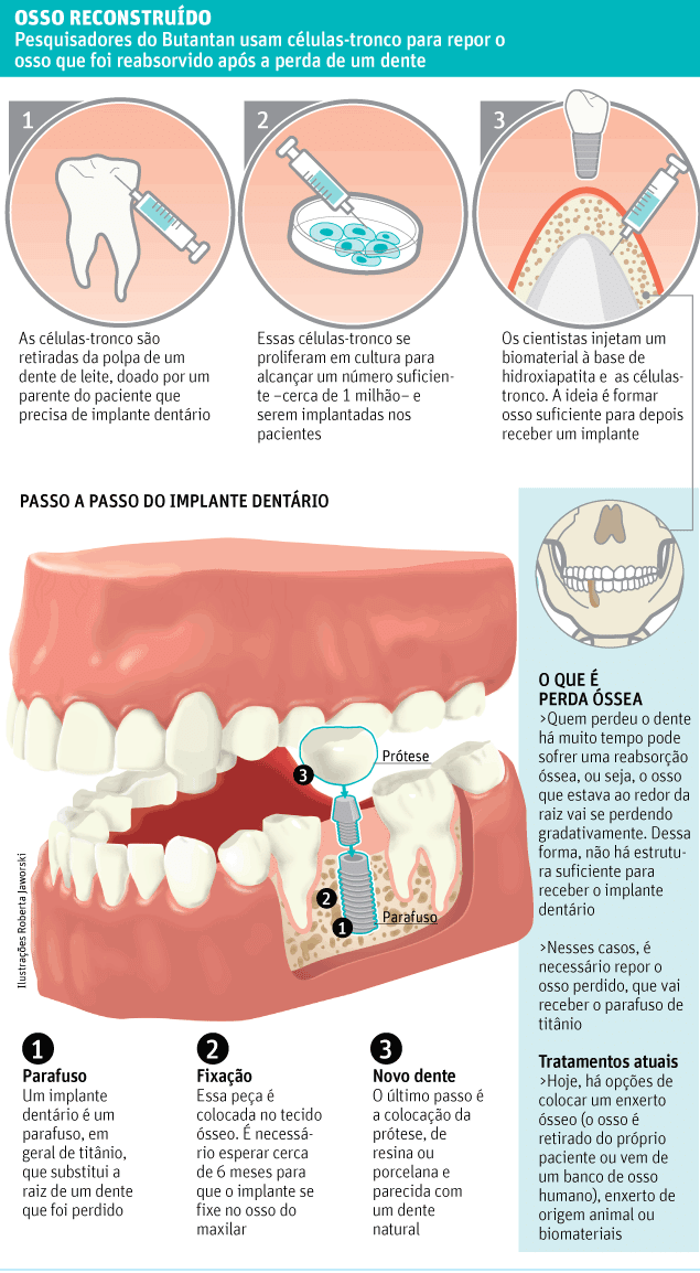 Células-tronco são usadas para regenerar cartilagem na mandíbula