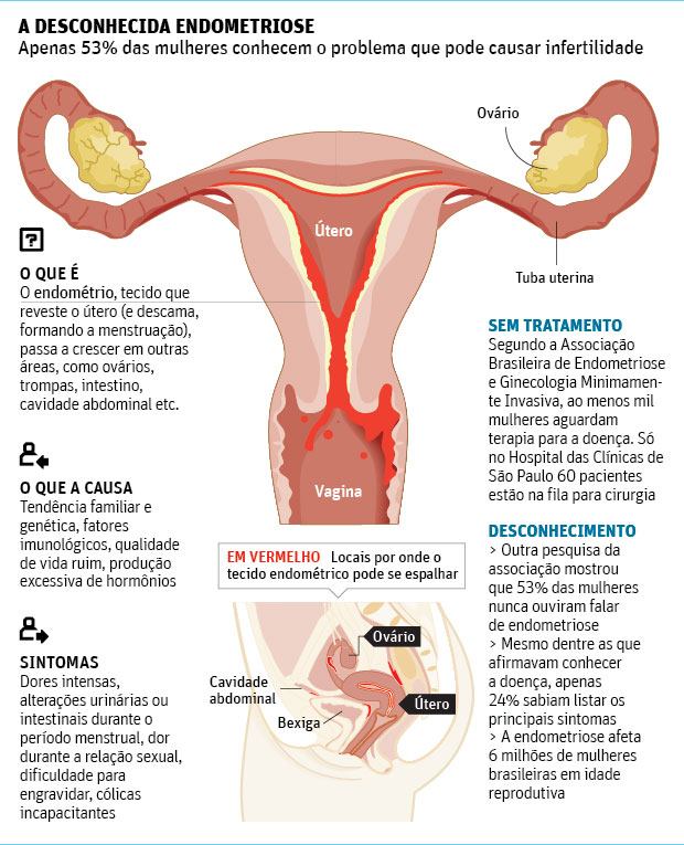 A mulher com Endometriose pode menstruar? - Humanize Diagnósticos