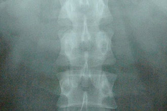 Radiografia de 2003
