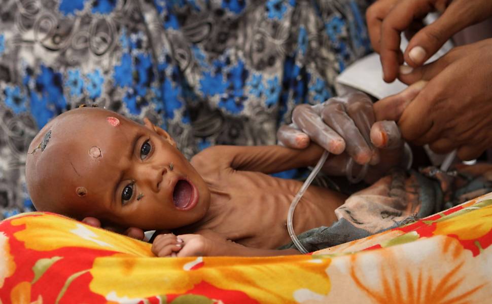 Fome na Somália