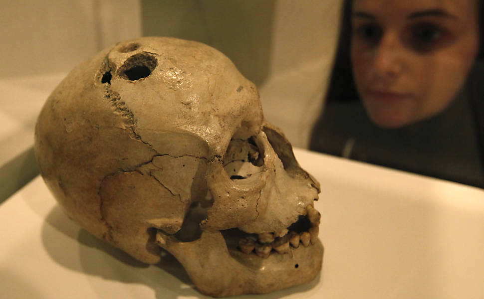 Perfurações em cérebro serviam para tratar doenças, consideradas espíritos ruins