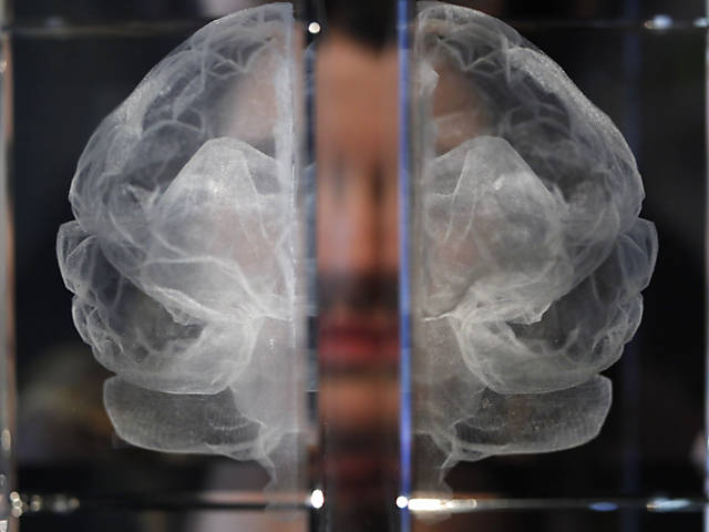 A obra em acrílico que foi produzida a partir de uma ressonância magnética da artista, Katherine Dawson