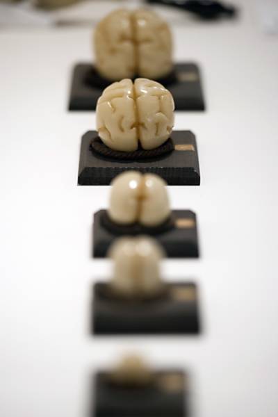 Evolução do cérebro humano desde a fase fetal