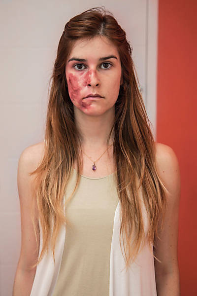 Fotógrafa retrata vítimas da violência doméstica