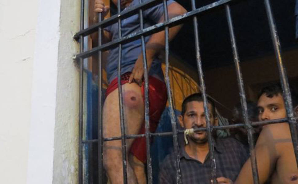 Preso mostra perna machucada durante rebelião em presídio de Manaus