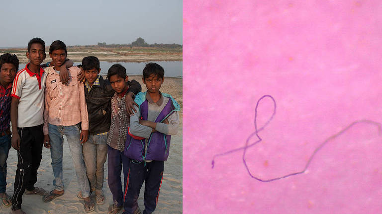 Fibra de plástico encontrada em Nova Déli, Índia. Das 16 amostras coletadas na cidade, 82% continham microplásticos