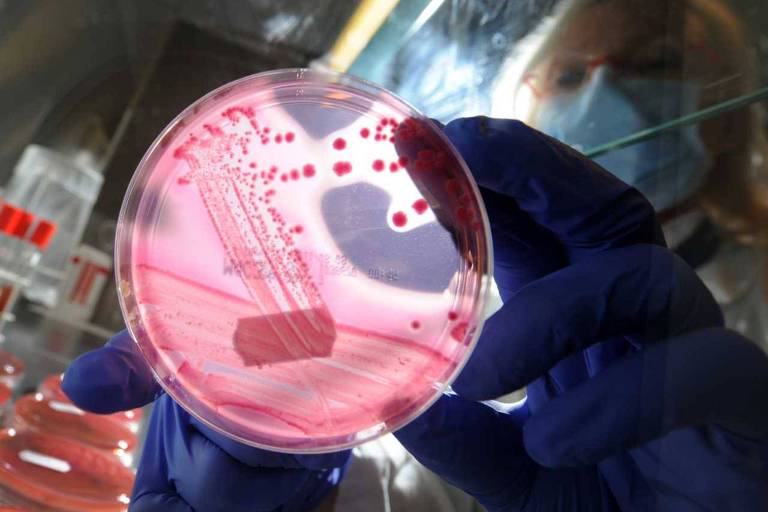 Pesquisador trabalha com bactrias Escherichia coli em laboratrio de Hamburgo, na Alemanha 