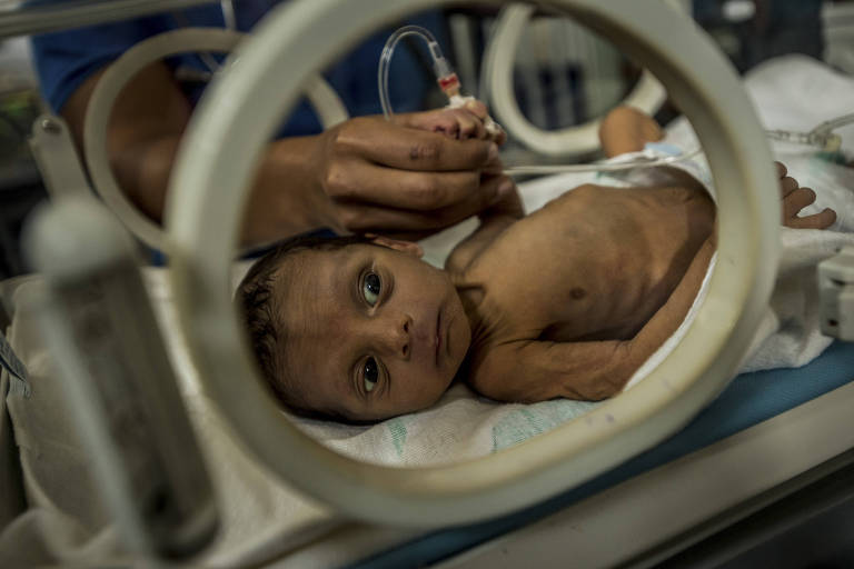 Desnutrição na Venezuela