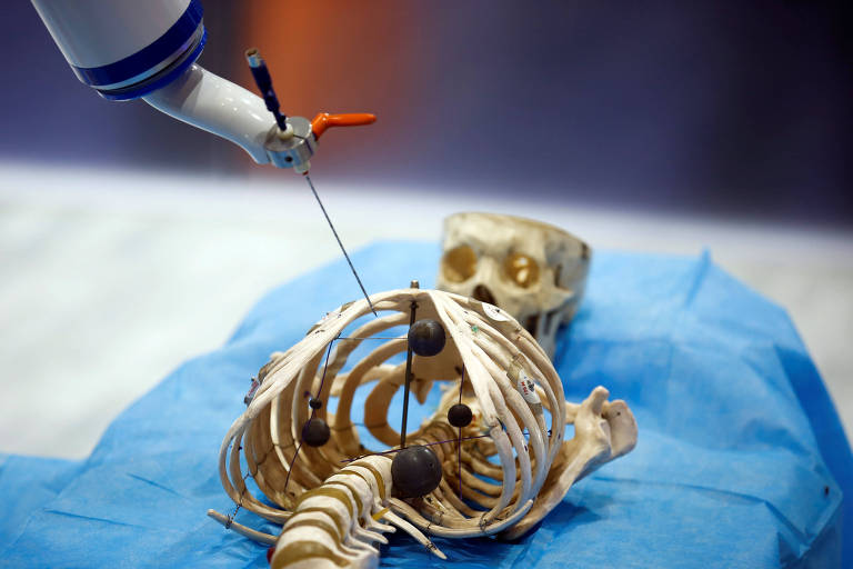 Um robô da Siasun Robot and Automation Corporation simula o manuseio de um instrumento cirúrgico em um modelo de esqueleto humano 