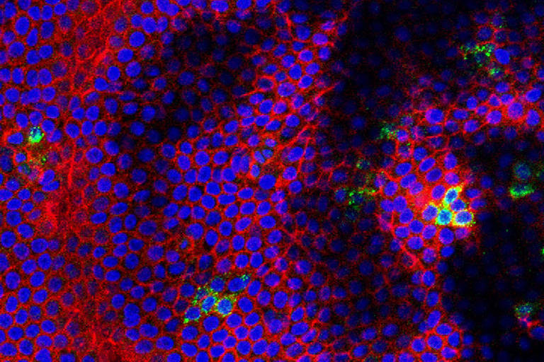 Vírus do oeste do Nilo (verde) em uma placenta humana, com células vermelhas e núcleos em azul