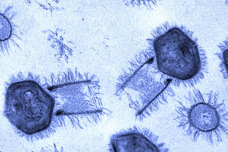 Imagem mostra os Tupanvírus. As partículas virais parecem pequenos microfones peludos. As maiores medem 2,3 micrômetros ou mícrons (cada mícron tem um milésimo de milímetro), e grande parte desse comprimento corresponde à cauda cilíndrica do vírus -algo que, por si só, já é inusitado, já que a grande maioria das partículas virais é formada apenas por uma espécie de carapaça, dentro da qual fica armazenado o material genético