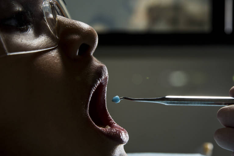 O que é e como tratar cárie dentária