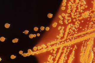 FILE PHOTO: Colonies of E. coli bacteria are seen in a microscopic image