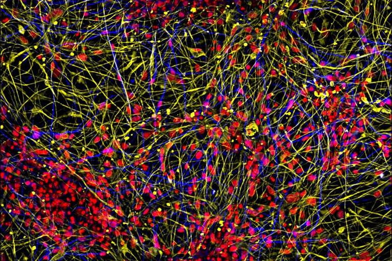 Intrincada rede de neurônios e astrócitos humanos (azul e amarelo, respectivamente). Em vermelho, é possível ver o núcleo celular