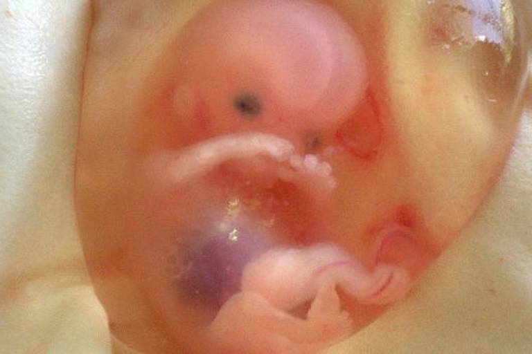 Piora na qualidade do esperma pode ser causada por substâncias absorvidas por fetos masculinos