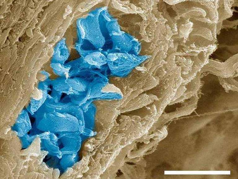 Fragmento de músculo do coração infectado pelo parasita Trypanosoma cruzi, colorido em azul para ressaltar. 