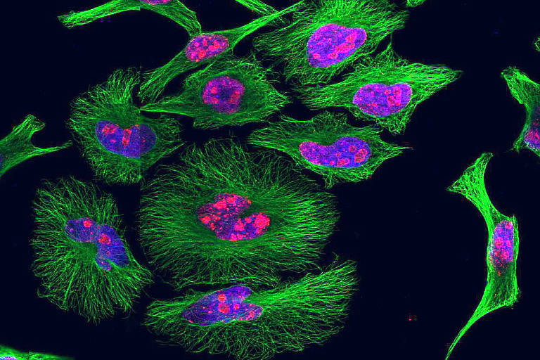 Células HeLa, derivadas de um câncer de colo de útero