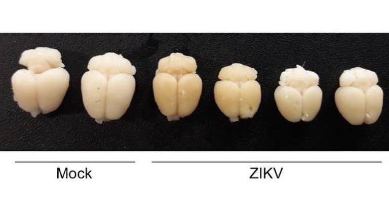 Comparação entre cérebros de camundongos. Os afetados pela zika são menores em relação aos normais