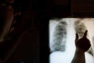 The Wider Image: Coal lobby fights black-lung tax as disease rates surge